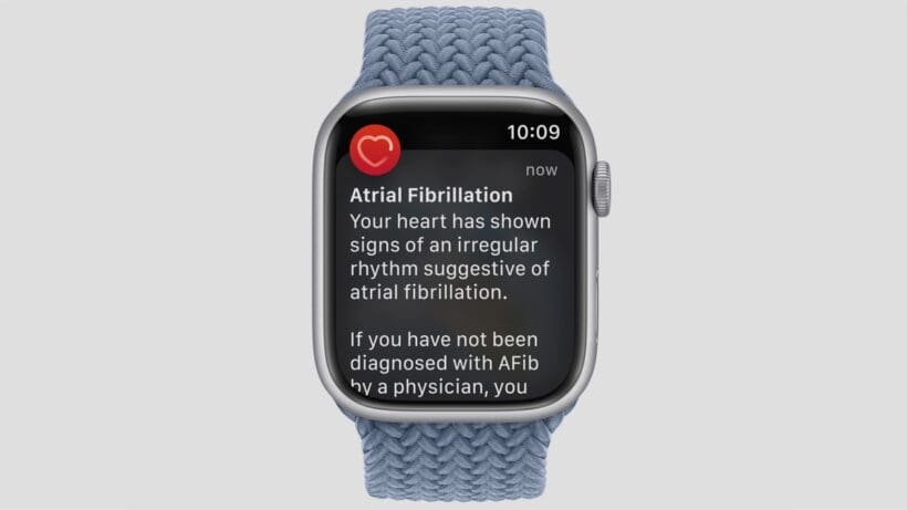 Study shows Afib wearables might have an unintended side effect