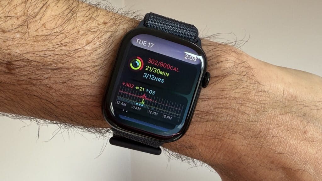 Apple Watch Series 10 smartstack