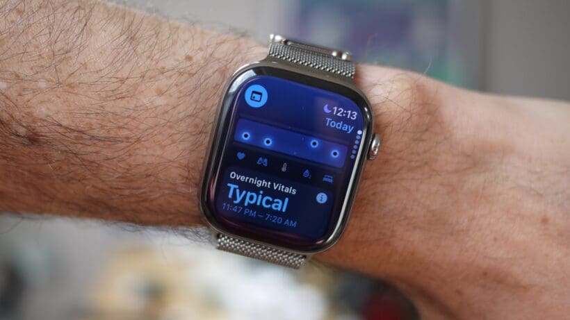 Apple Watch Series 10