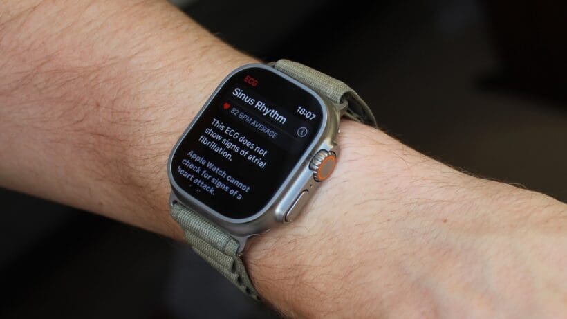 apple-watch-ultra-sinus-rhythm