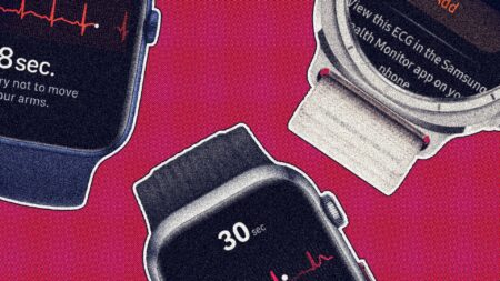 best-ecg-watches