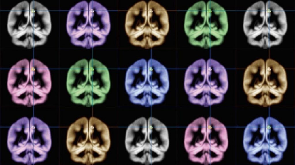 Is wearable tech in its mature, boring phase yet? SXSW 2017 says hells no