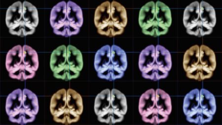 An Oculus exec wants to build affordable, wearable MRI machines An Oculus exec wants to build affordable, wearable MRI machines