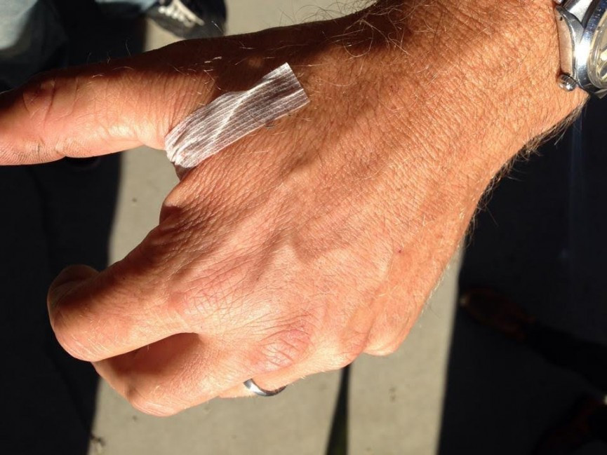 US presidential candidate gets RFID/NFC chip implanted in his hand
