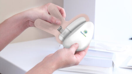 RespiraSense receives NHS Innovation Accelerator backing