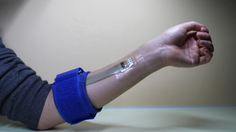 Sony and Ericsson team up to develop a wearable for on-the-go diabetes tracking