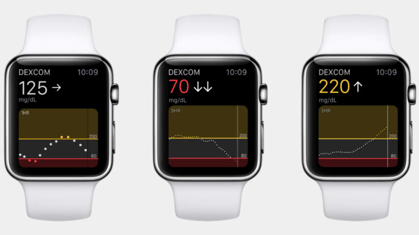Apple Watch vs diabetes: The glucose monitoring story so far