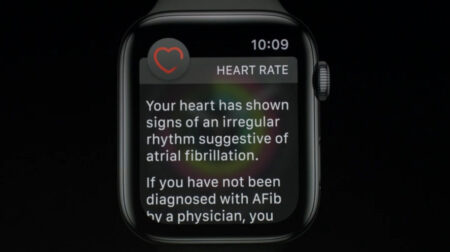 Apple Watch Series 4 ECG feature could take years to be approved in the UK