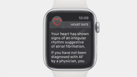 Apple Watch ECG app brings atrial fibrillation detection to the UK