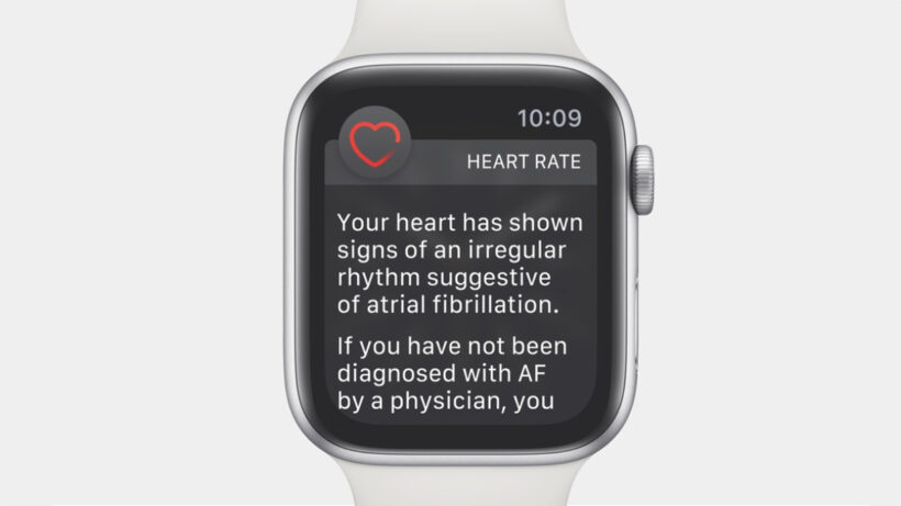 Apple Watch ECG app brings atrial fibrillation detection to the UK