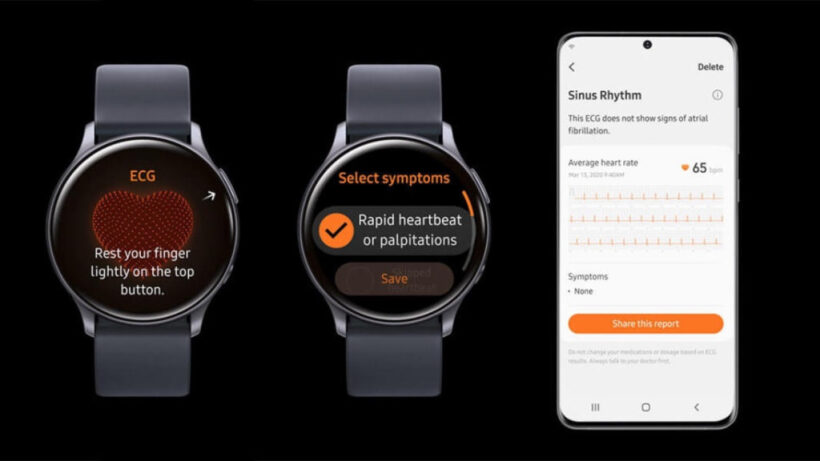 ​Samsung Galaxy Watch models get ECG feature