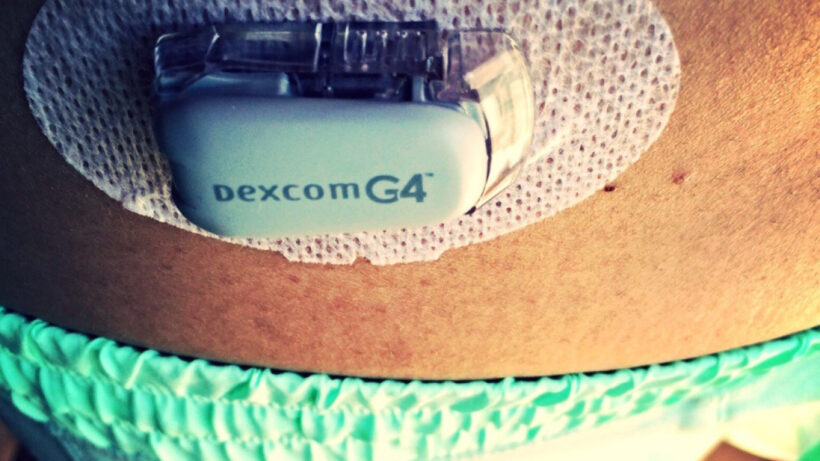 Google on board for next-gen glucose monitoring for diabetics