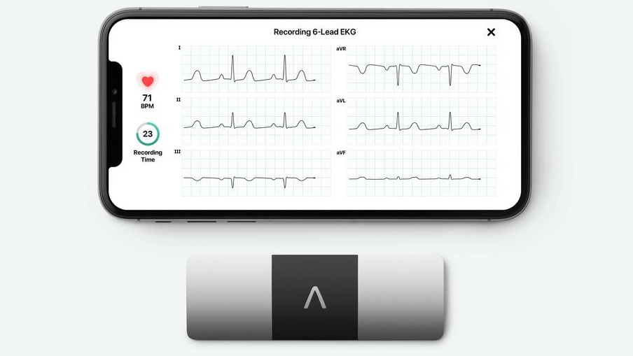 Qualcomm Wearables Ecosystem Accelerator Program: Why it takes a village to build a wearable photo 2