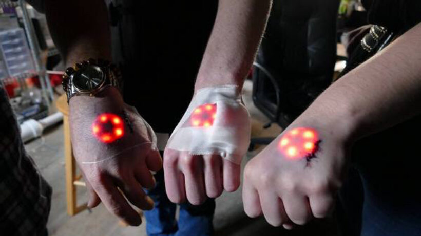 You can now watch grinders implant LEDs into their hands