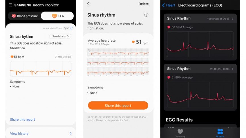 active-2-ecg-1614682480-JwFO-column-width-inline