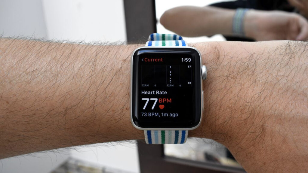 Learning to wear a smartwatch in (our) age of anxiety