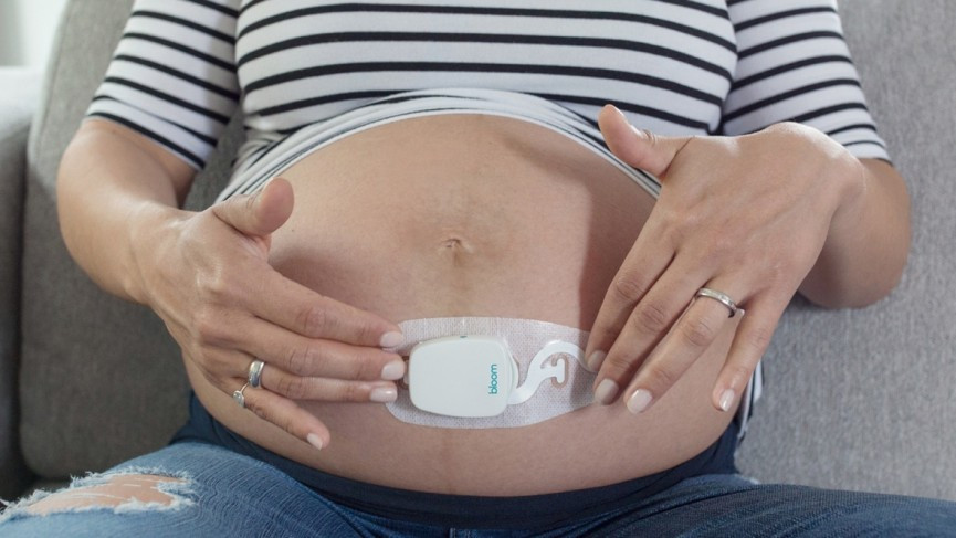 Bloomlife wants to be your personal pregnancy coach