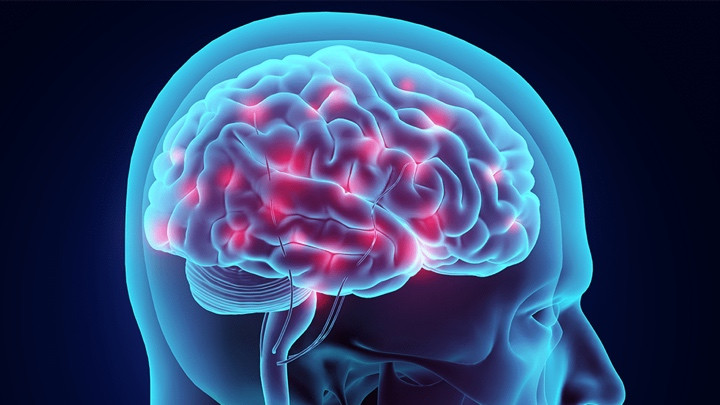 Apple Watch studies: How the smartwatch is tackling health issues