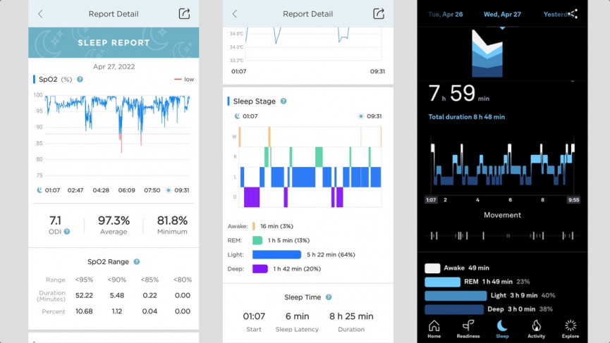 Oura Ring 3 v Circul+: Battle of the smart rings