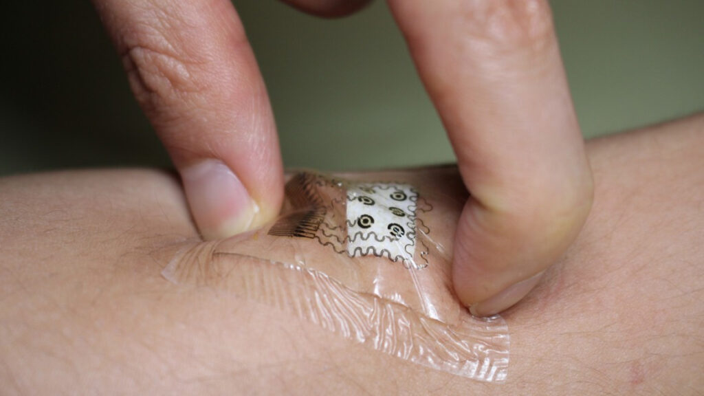 How wearable tech is bringing normality to the lives of diabetics