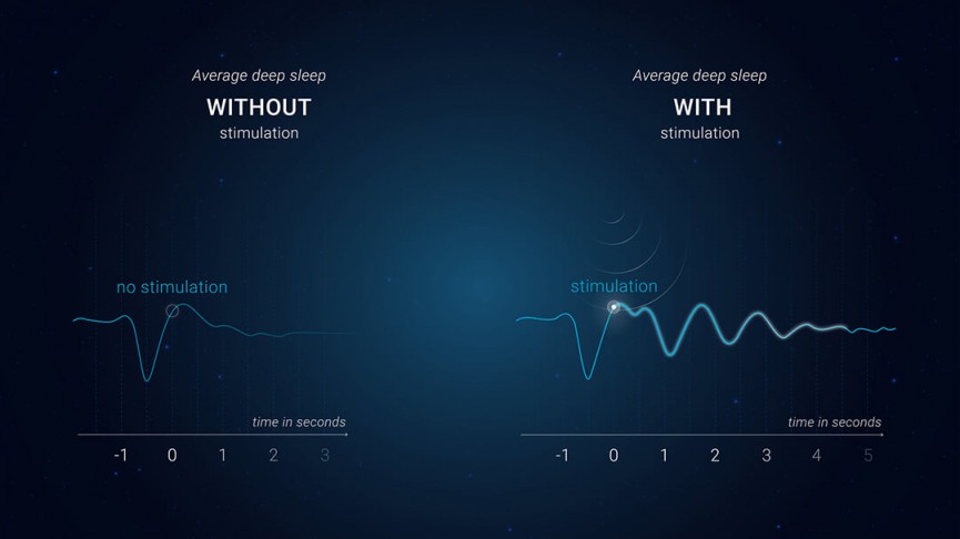 Rythm plans to put lab-quality sleep data in your hands this year