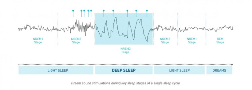 Rythm Dreem headband promises you'll sleep better wearing it