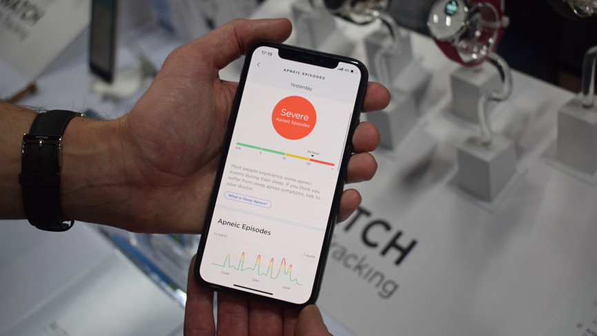 Second coming of sleep tracking: Why sleep wearables mean business in 2020