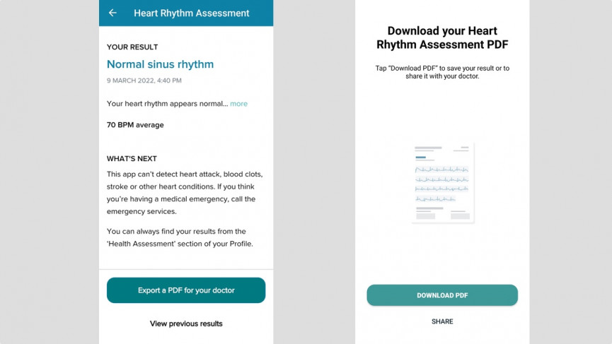 How to use ECG on Fitbit Charge 5