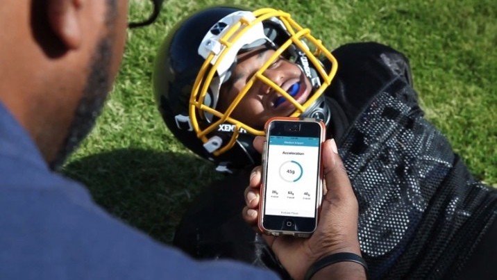 fitguard-mouthguard-1420683974-JZvj-column-width-inline