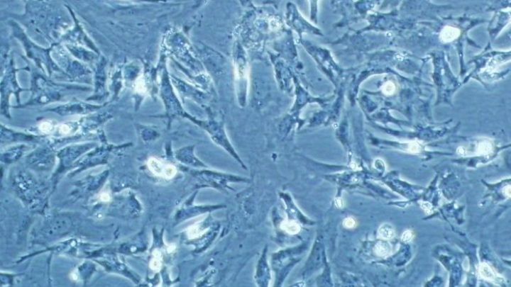 Beyond sci-fi: Building the bionic body