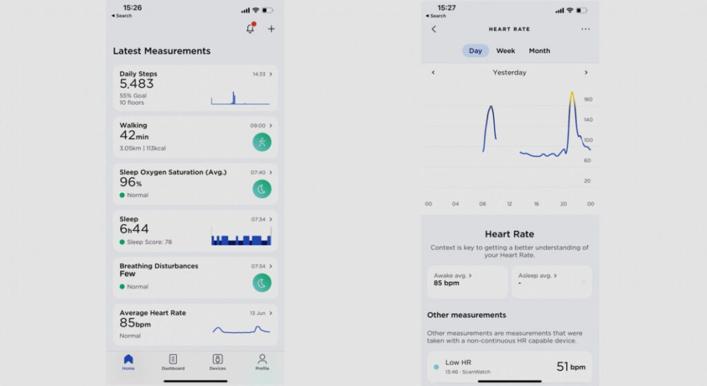 Withings ScanWatch Horizon review