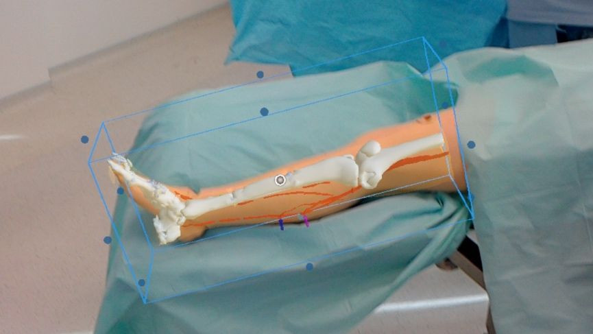 Microsoft HoloLens is finding its way into the operating theatre