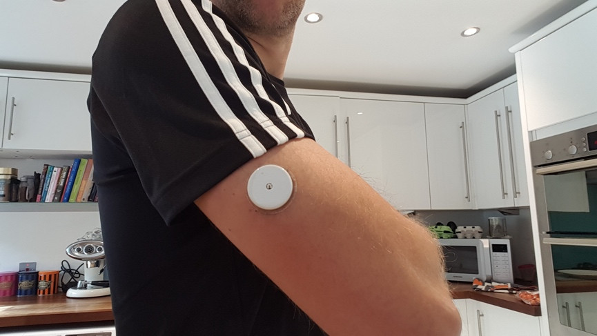 What I learned wearing a real-time blood glucose monitor