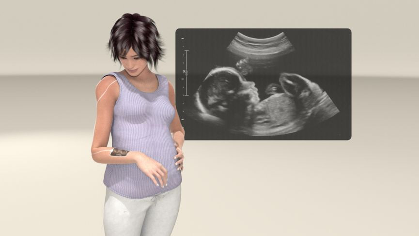 Inside Stanford labs, stretchables are ushering in a new wearable revolution