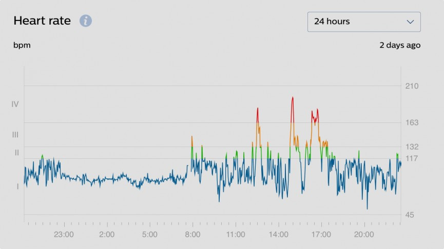 Philips Health Watch review