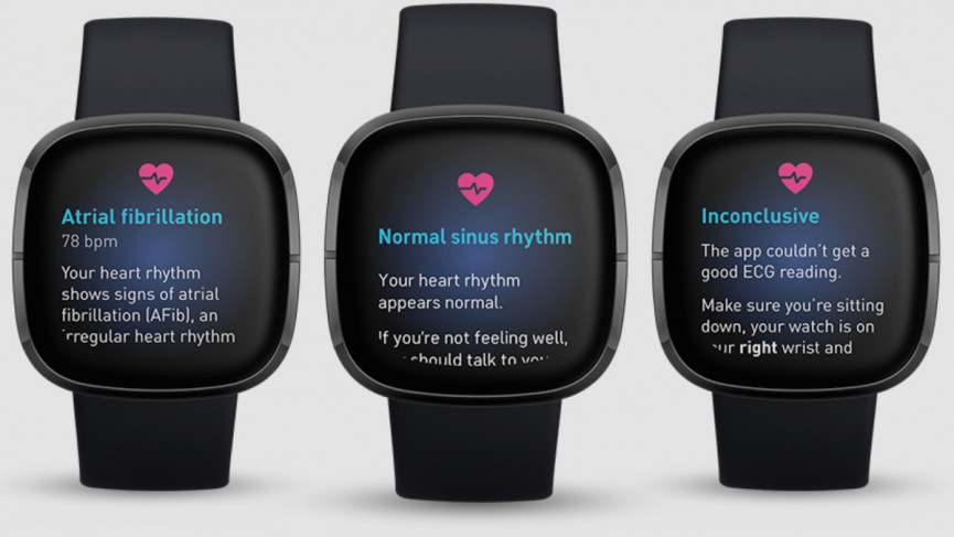 ​Fitbit co-founder: ‘We lead and others follow’ – here's where Fitbit's heading next