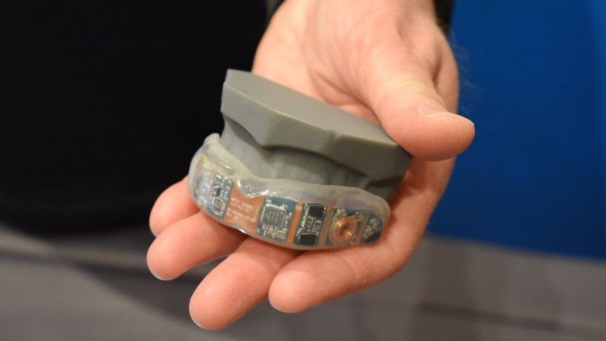 Prevent's smart mouthguard detects concussions, helping players avoid injury