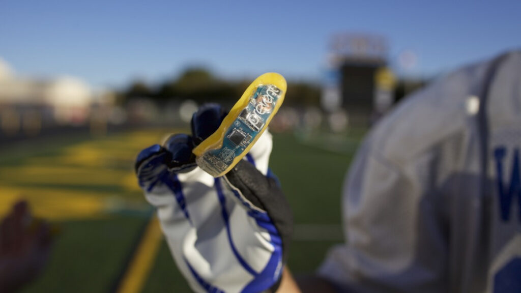 How wearables can detect sport’s deadly invisible injuries