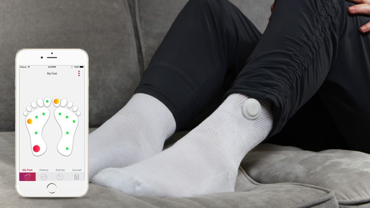 And finally: Smart socks for diabetes patients and more