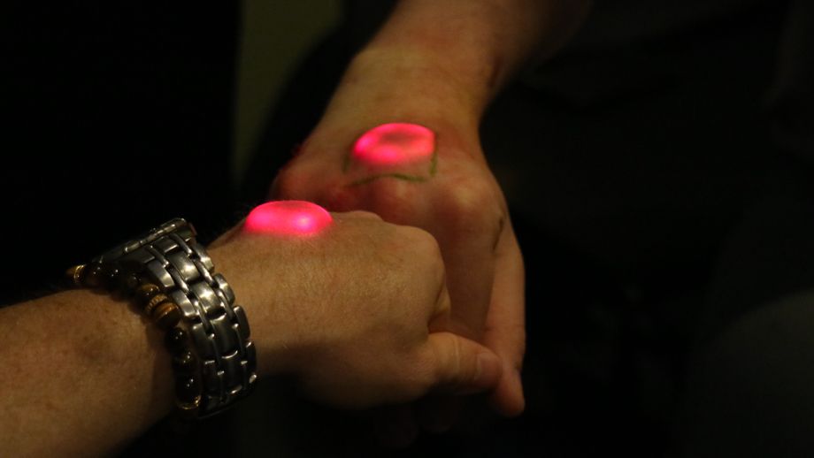 The biohacking scene is gearing up for next-gen implants