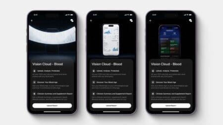 vision-cloud-ultrahuman