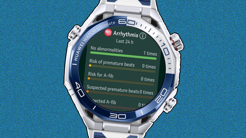 Huawei Watch Ultimate 2 gains heart failure and coronary disease screening